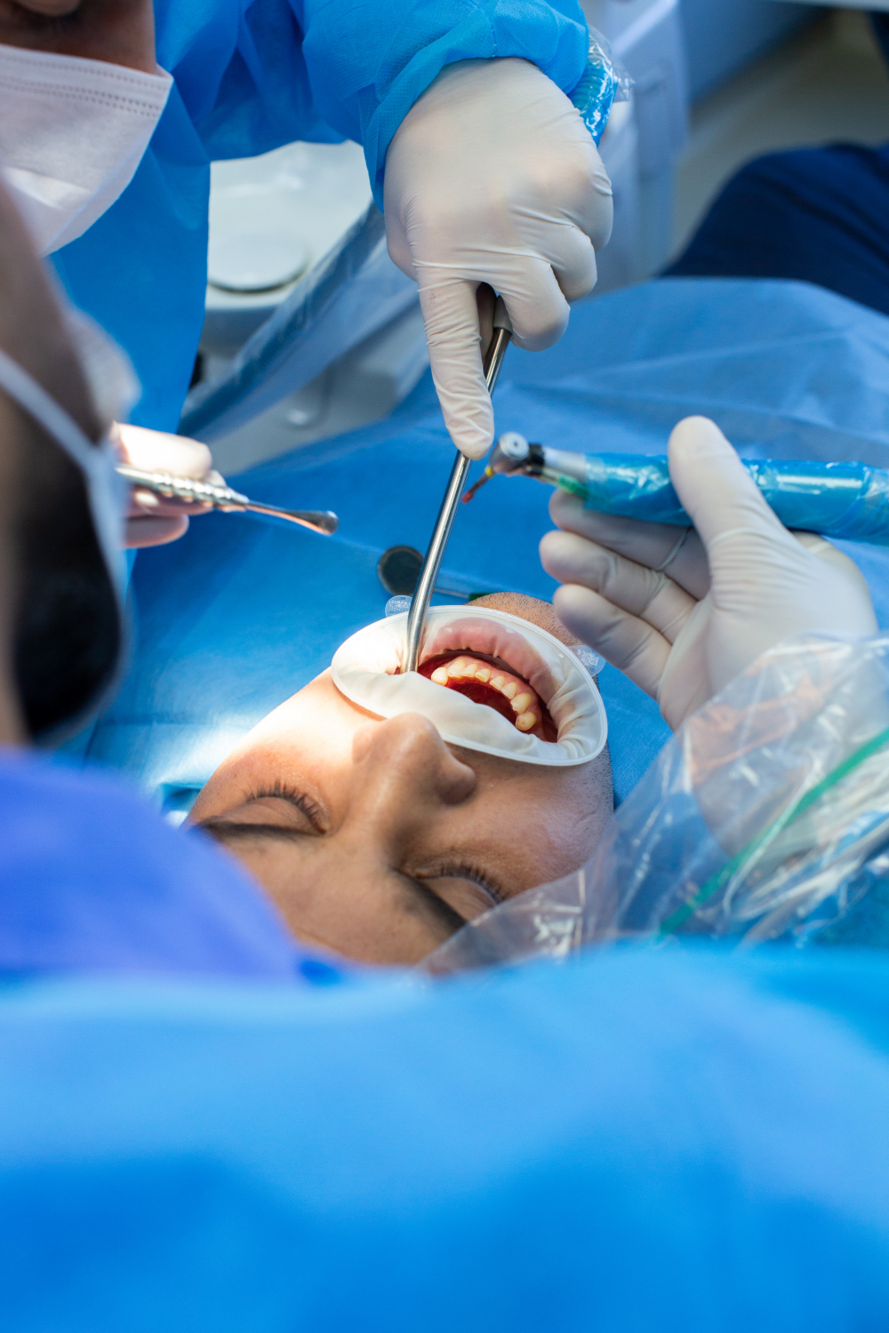 antibioest actualites chirurgie dentaire