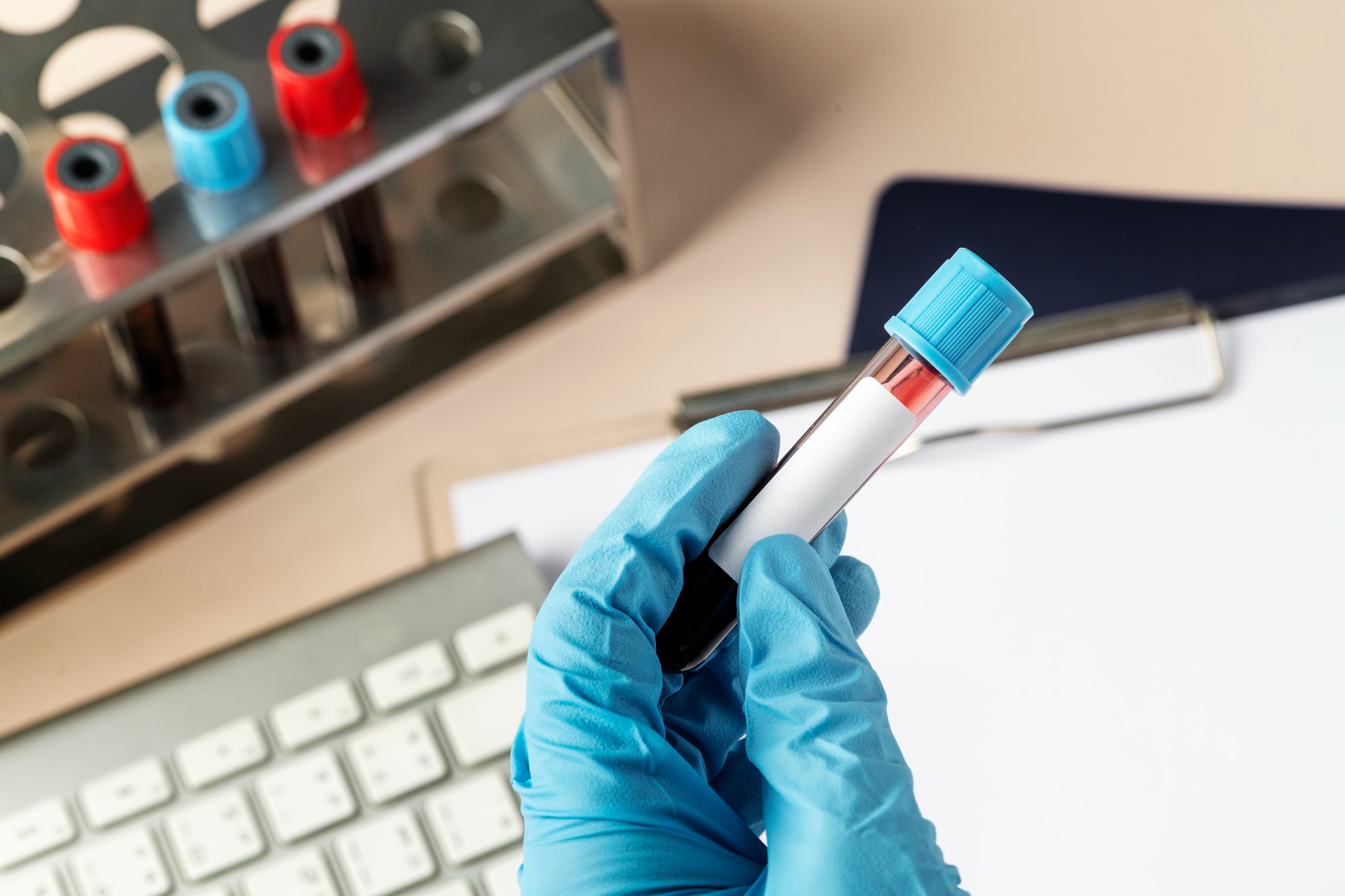 antibioest nl test sur sang 