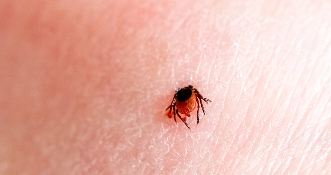 antibioest nl tick embedded person skin ok 